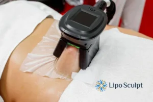 Cryolipolysis Helping You Getting that Perfect Summer Body 3 Cryolipolysis Dorset can give you the best summer body - contact us today!