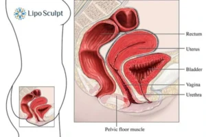 Treatment For A Leaky Bladder 2 How EM Chair treatment Dorset can help Leaky bladder issues. Read more now!