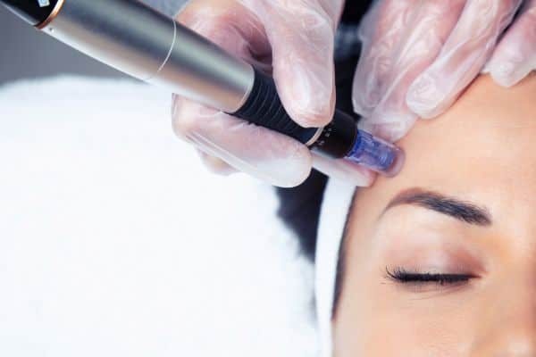 Explaining Total Skin Tightening Treatment and What to Expect 2 What Skin Concerns Can Total Skin Tightening Treatment Help With Dorset?